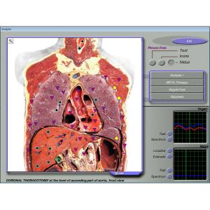 Quantum Resonance 3d Nls Health Analyzer For Body Detection