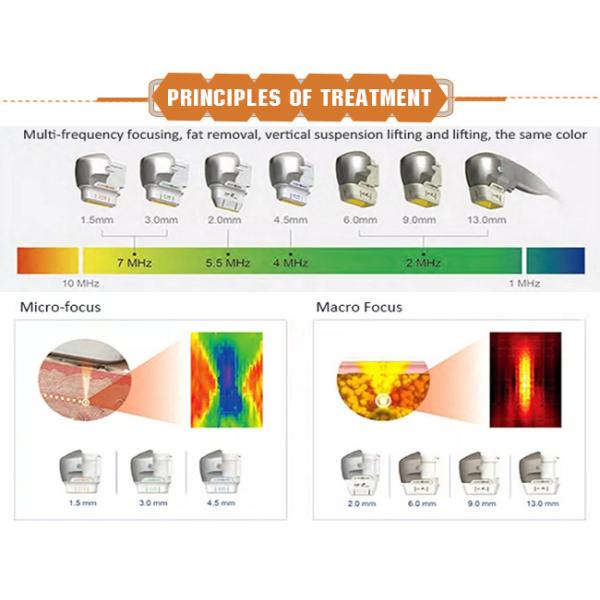 25mm HIFU Slimming Machine 3d Portable Hifu Ultrasound Facelift