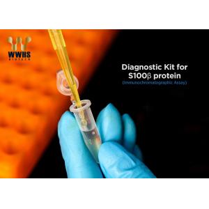 S100-β Rapid Quantitative Test Kit FIA POCT Assay High Sensitivity