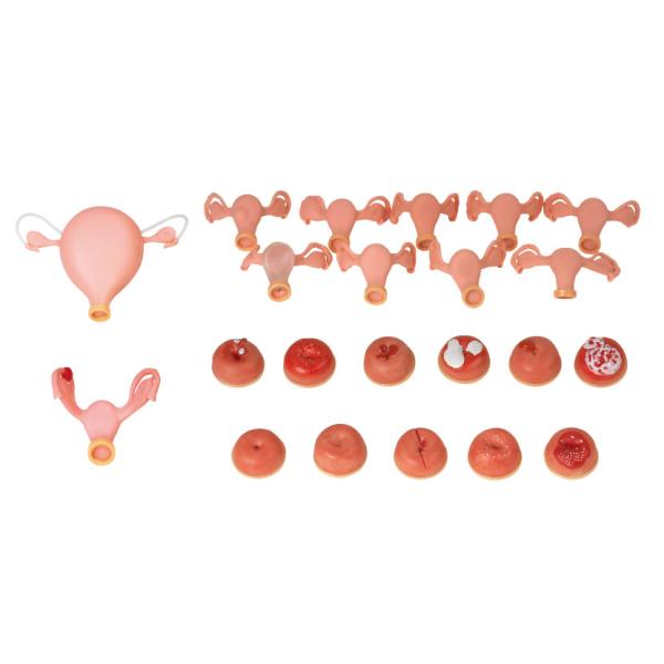 Replacement Uterus Gynecologic Simulator Vaginal Pelvic Exam Simulator