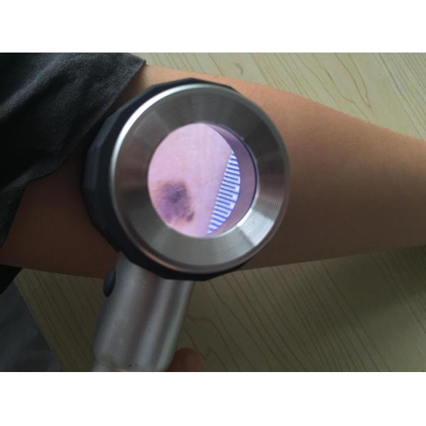 Buy Customized Health Care Handheld Medical Dermatoscope for Skin Inspection at wholesale prices