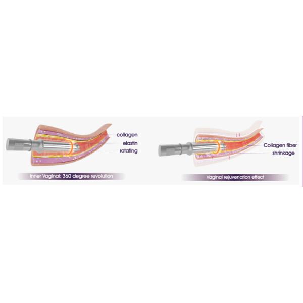 30W Co2 Fractional Laser System Tightening CO2 Laser Machines