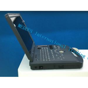 Clinic Ultrasound Scanner M-C60 Portable Color Doppler Ultrasound System
