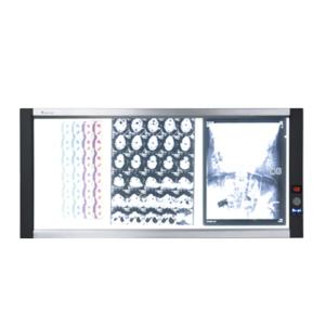 Quality LED x-ray film viewerled medical film viewer for sale