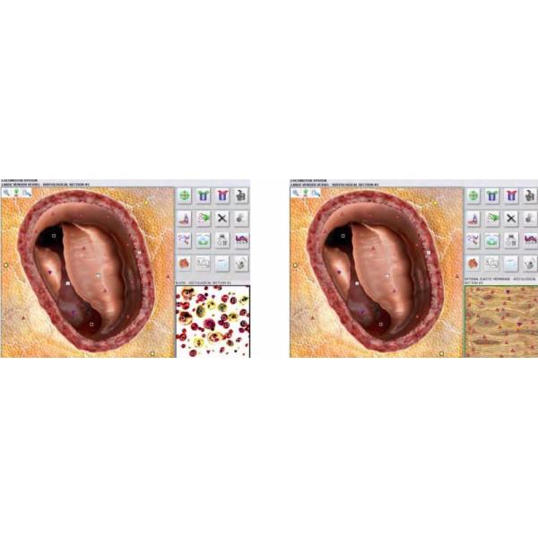 Metatron hunter 4025 with german software