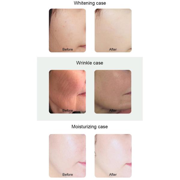 Multifunctional 6 In 1 Hydrafacial Machine Cleansing Facial Care Skin Rejuvenation