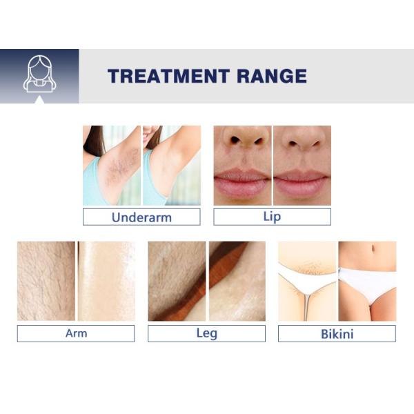 Long pulse q switch 755 1064 nd yag alexandrite laser hair removal machine price