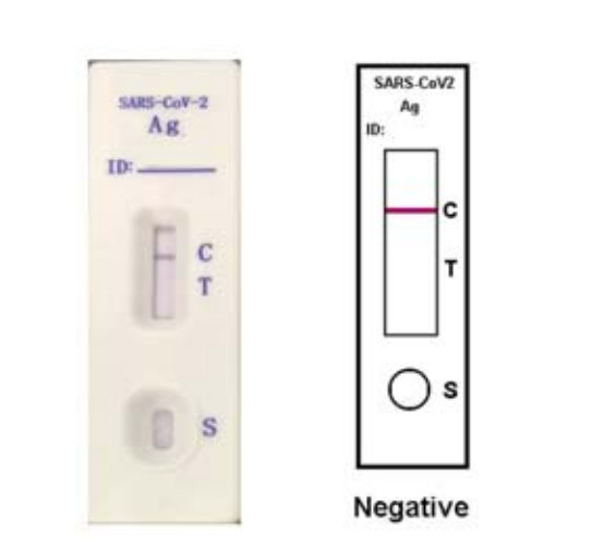 SARS-CoV-2 Antigen Rapid Test for COVID-19 Coronavirus 2, diagnosis of COVID-19