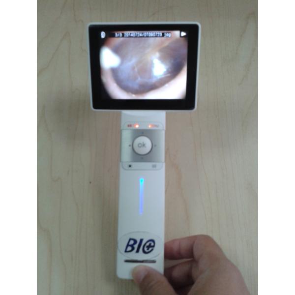 Professional Ear Skin Throat Camera Digital Video Otoscope With 1920 x 1080 Pixels