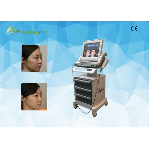 Buy 2 years warranty Medical HIFU face lift machine /4.5mm hifu face and neck lift at wholesale prices