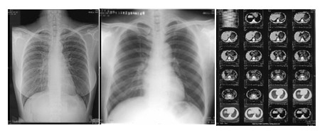 Buy 14in X 17 Inch Thermal Printer Film at wholesale prices