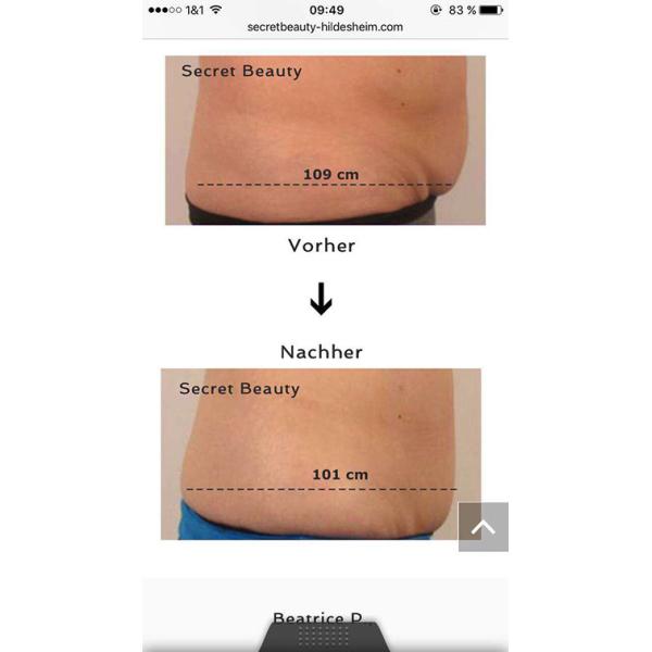 Beautiful Design High Quality Manufacturer Direct Sale Portable Cryolipolysis Machine For