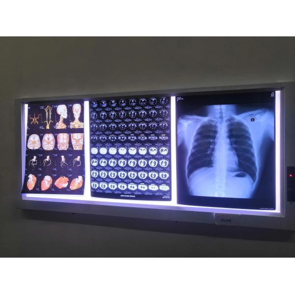 125/150/180 Microns Inkjet X Ray Film With White Opaque Color Printing Speed 1-3 Minutes