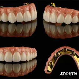 Ti Bar Zirconia Hybrid Implant Bridges High Translucency For Dental Prosthesis