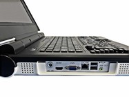 15 Inch LED Color Portable Ultrasound Machine with 60deg Scan Angle and