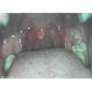 3.5 Inch LCD Monitor Handheld Otoscope Opthalmoscope Diagnostic Video Camera