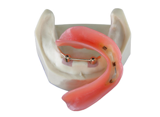 Buy High Biological Inter Miscibility Denture Dental Lab Safety Implant at wholesale prices