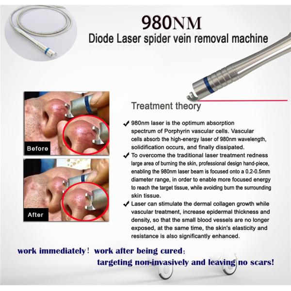 Portable Diode 980nm Laser Spider Vein Removal Machine / Vascular Laser Machine