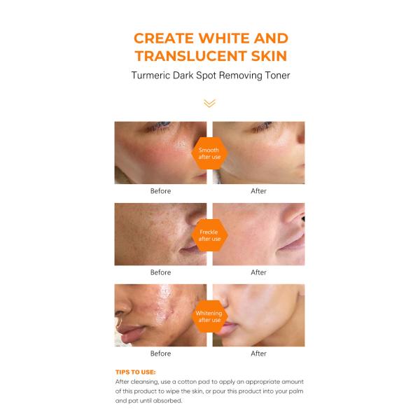 Private Label Face Toner Moisturizing Spray Deep Face Hydrating Quickly Absorb VC Whitening Skin Moisturizing Face Spray