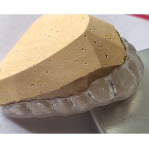 Transparent Night Guard For Bruxism