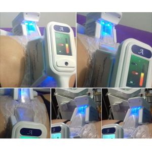 4 handles Coolsculpting body slimming cryolipolysis fat freeze slimming machine