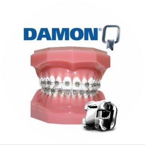 Middle Torque Slot 0.022 Dental Brackets Self-ligation/Self-locking Braces for