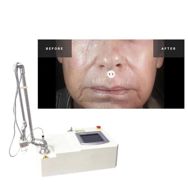 Buy Portable 15w Co2 Fractional  Acne Surgical Scar Laser Machine at wholesale prices