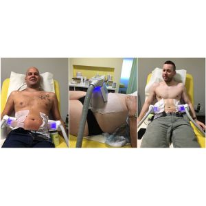 5 handles Cryolipolysis slimming device Coolsculpting fat freeze slimming