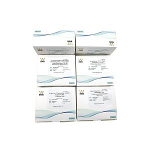 FIA One Step PCT Rapid Quantitative Test Kit Inflammation Detection