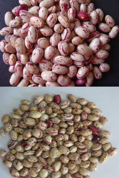 Multifunction Newest Software Kidney Beans Color Sorting Machine Beans Color Sorter