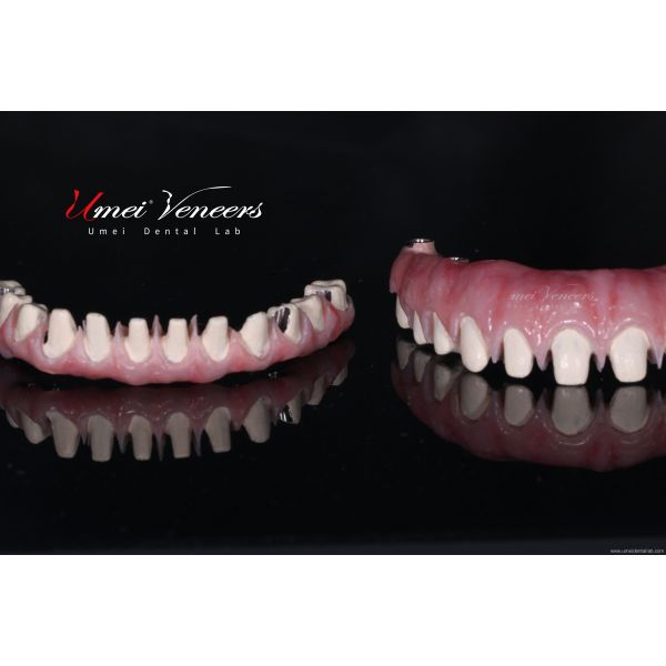 Buy Good biocompatibility zirconia bridge at wholesale prices