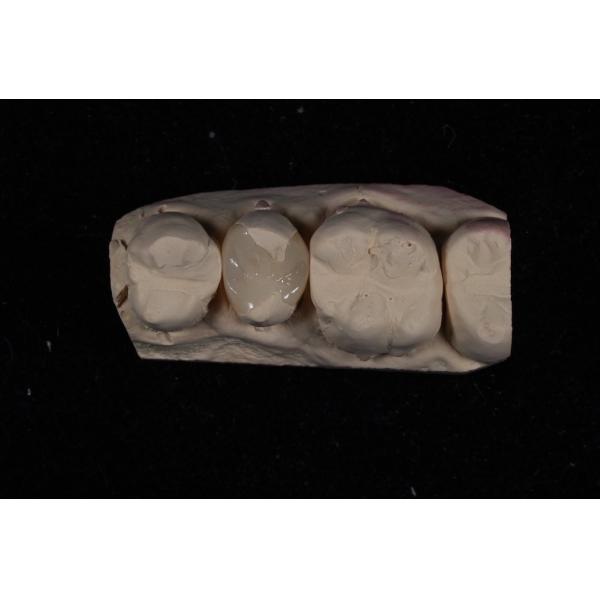 Buy Strength Emax Ceramic Veneers Crown With Excellent Stain Resistance / Biocompatibility at wholesale prices