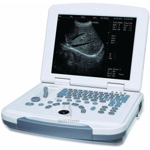 China Laptop Ultrasound Scanner on sale