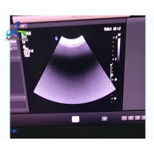 EPIQ 5 Ultrasound Machine Repair Startup Report Error 025 Replace ACQ