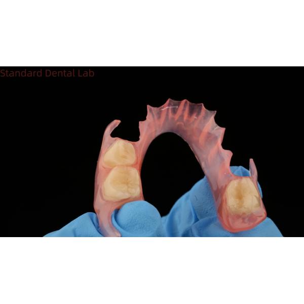 3D Print Model Dental TCS Valplast Flexible Partial Dentures Pink / Dark Color Dental Lab Product