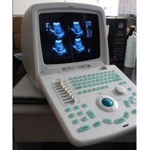 Quality Portable Color Doppler Portable Ultrasound Scanner with Detectable depth of 2~30cm for sale