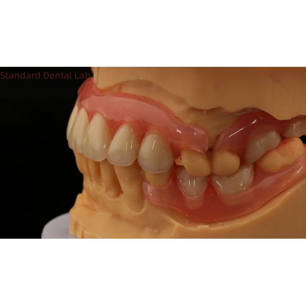 3D Print Model Dental TCS Valplast Flexible Partial Dentures Pink / Dark Color Dental Lab Product