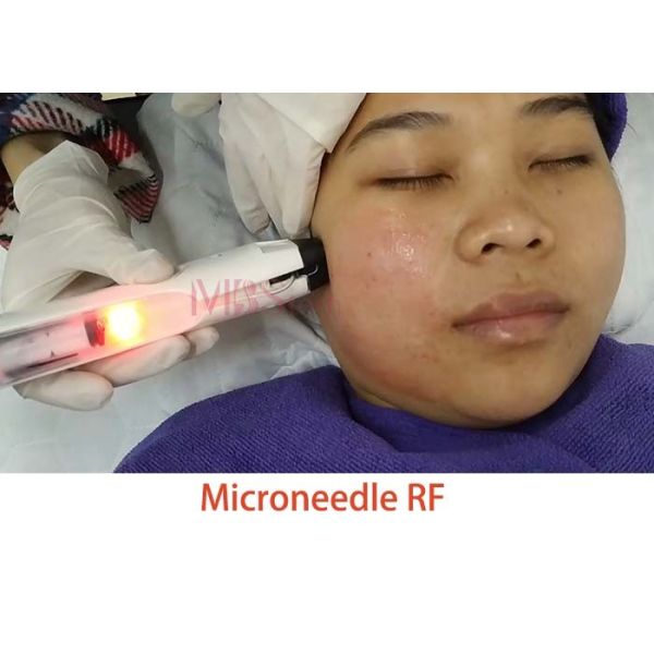 Mesotherapy Skin Face Lift Fractional Microneedle RF Machine