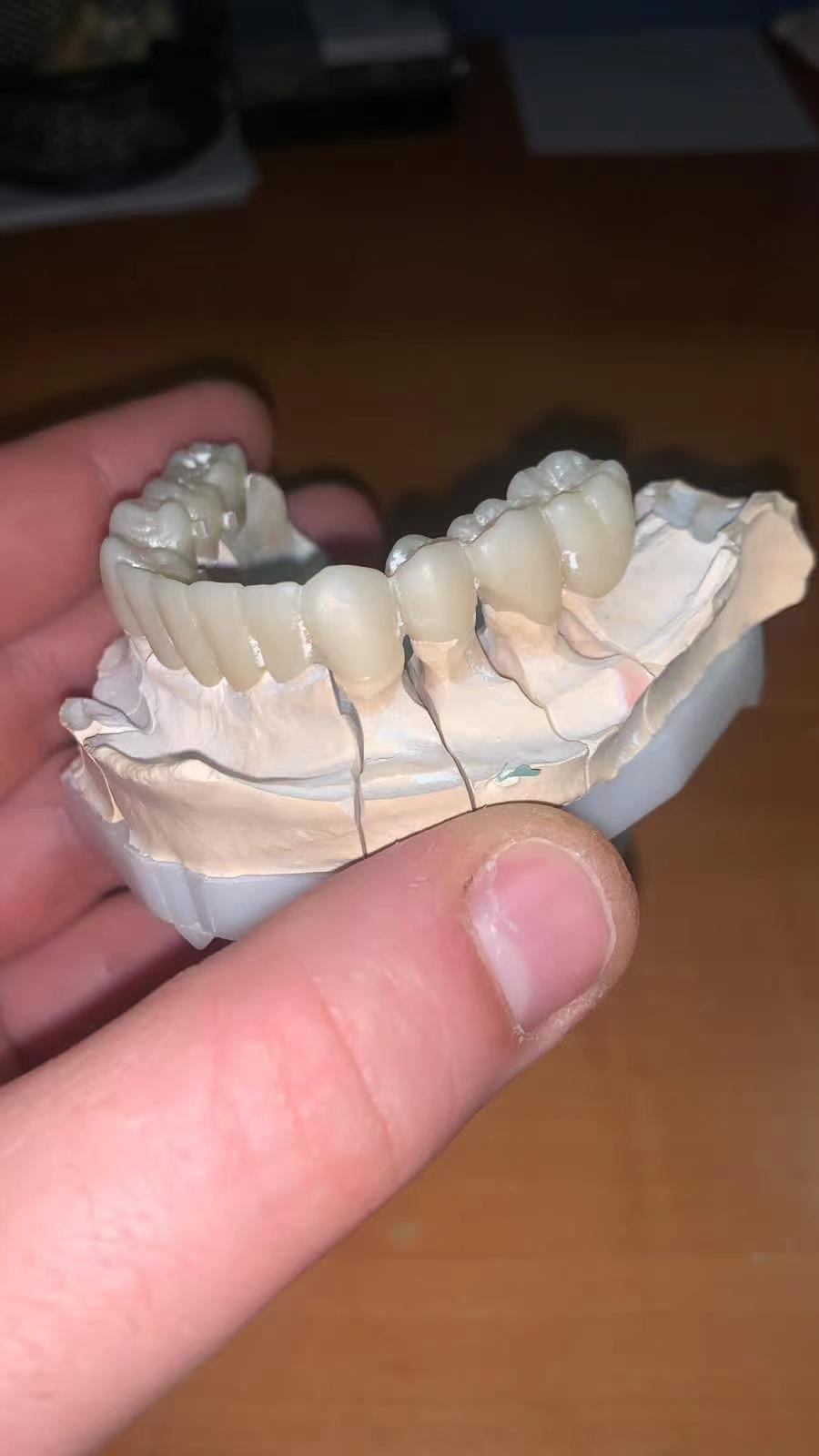 Dental A3 Multilayer Zirconia Block 1050 Mpa Zirconium Oxide Ceramic FDA