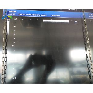 PLU-1204BT 18L7 Linear Ultrasound Transducer Compatible Xario 100/200