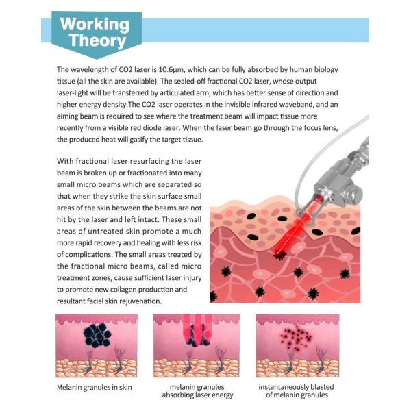 Stretch Removal Laser CO2 Fractional Beauty Machine with 7-Joint Arm Light Guiding System