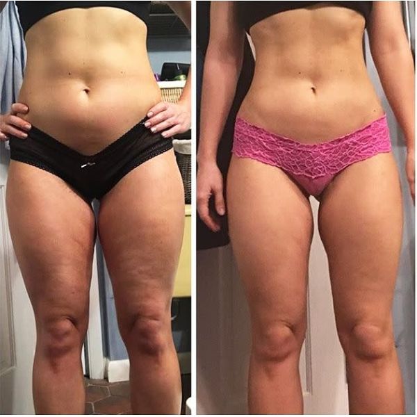 Infrared Portable Body Slimming Machine 5d Massage Roller Cellulite Removal Vacuum Roller Massage