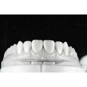 Flexible Denture Finish Revolutionize Your Dental Practice With Natural Tooth