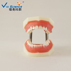 Professional Medical Dental Study Models VIC-L5 Peridontal Disease Model