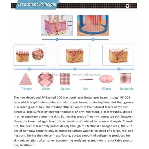 Aluminum Case Co2 Fractional Laser Machine With Skin Resurfacing Capabilities
