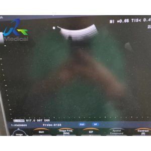 China Aloka UST-5299 Ultrasound Transducer Probe Replace Crystal Solutions on sale