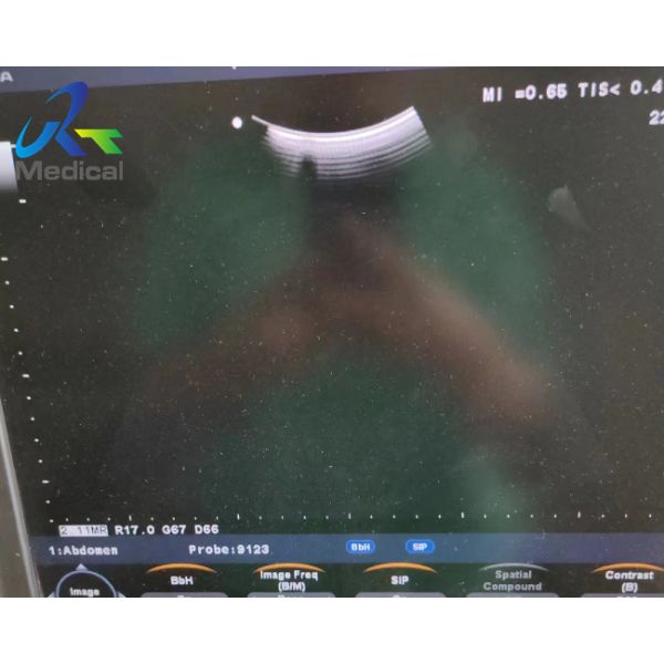 Buy Aloka UST-5299 Ultrasound Transducer Probe Replace Crystal Solutions at wholesale prices