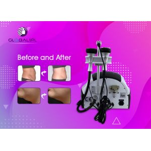 Weight Reduction RF Cavitation Slimming Machine Skin Tightening Beauty Machine