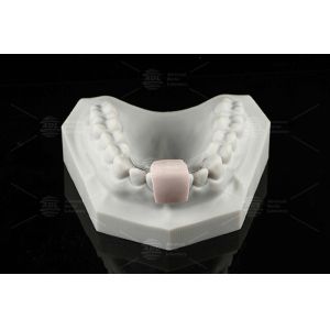 Non Removable Lingual Wire Retainer Invisible Direct Bonded Lingual Retainer