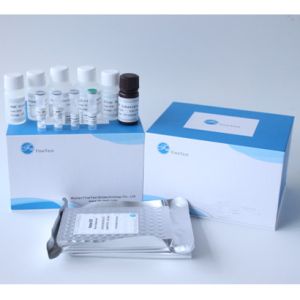 China PLGF Placental Growth Factor Elisa Test Kit on sale